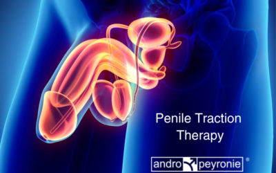 2023 Penile traction device improves Erection